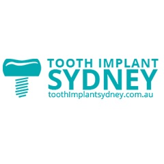Tooth Implant Sydney Provide Quality Dental Implants with Latest Equipment in Dentistry
