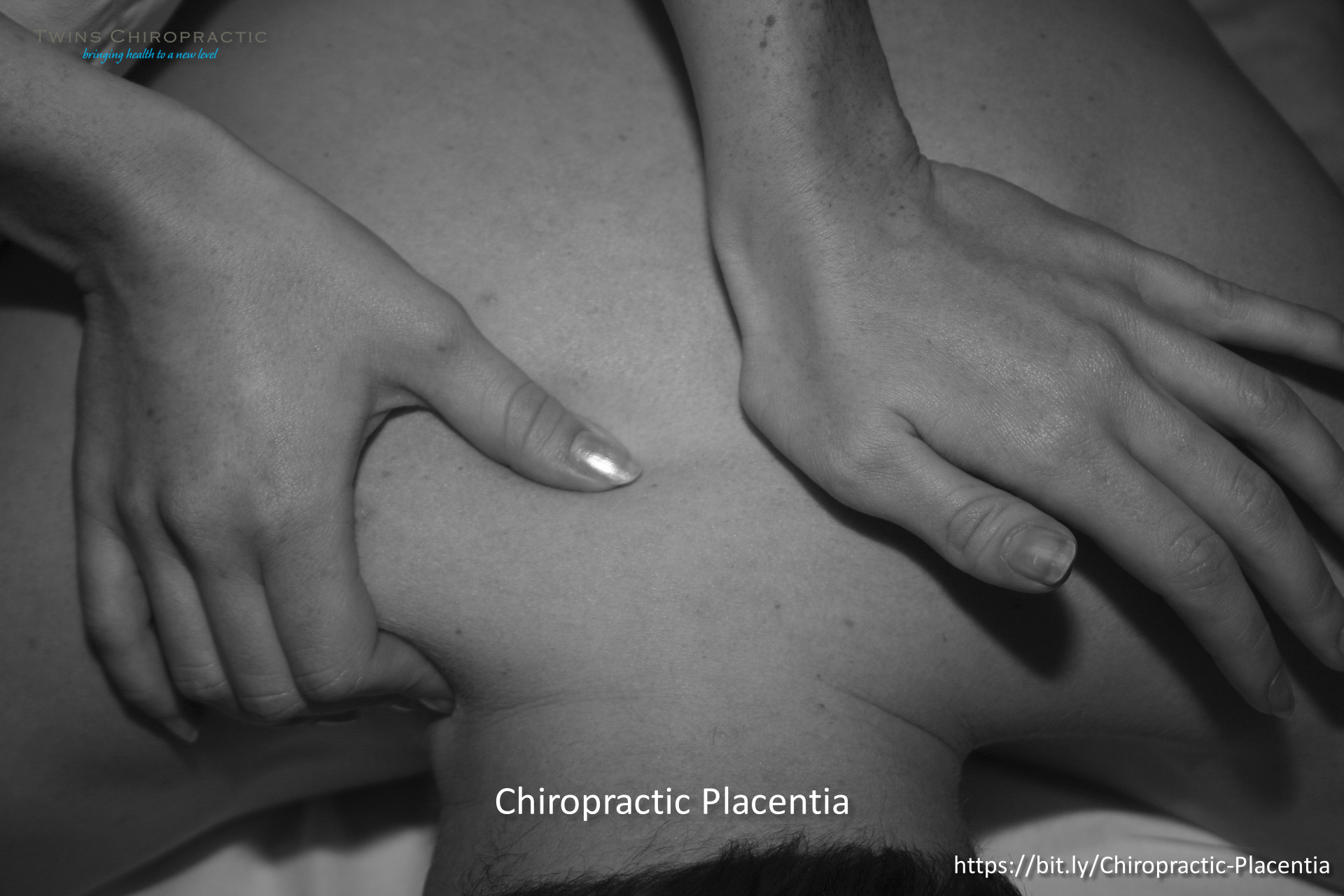 Twins Chiropractic Explains their Treatment Procedure for New Patients