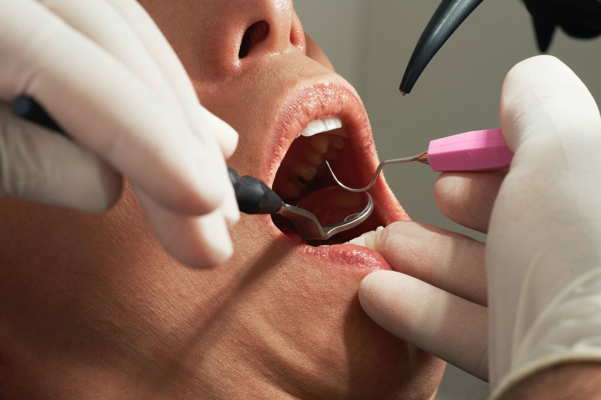Realtimecampaign.com Discusses the Cosmetic Benefits Offered by a Dentist Fort Worth 