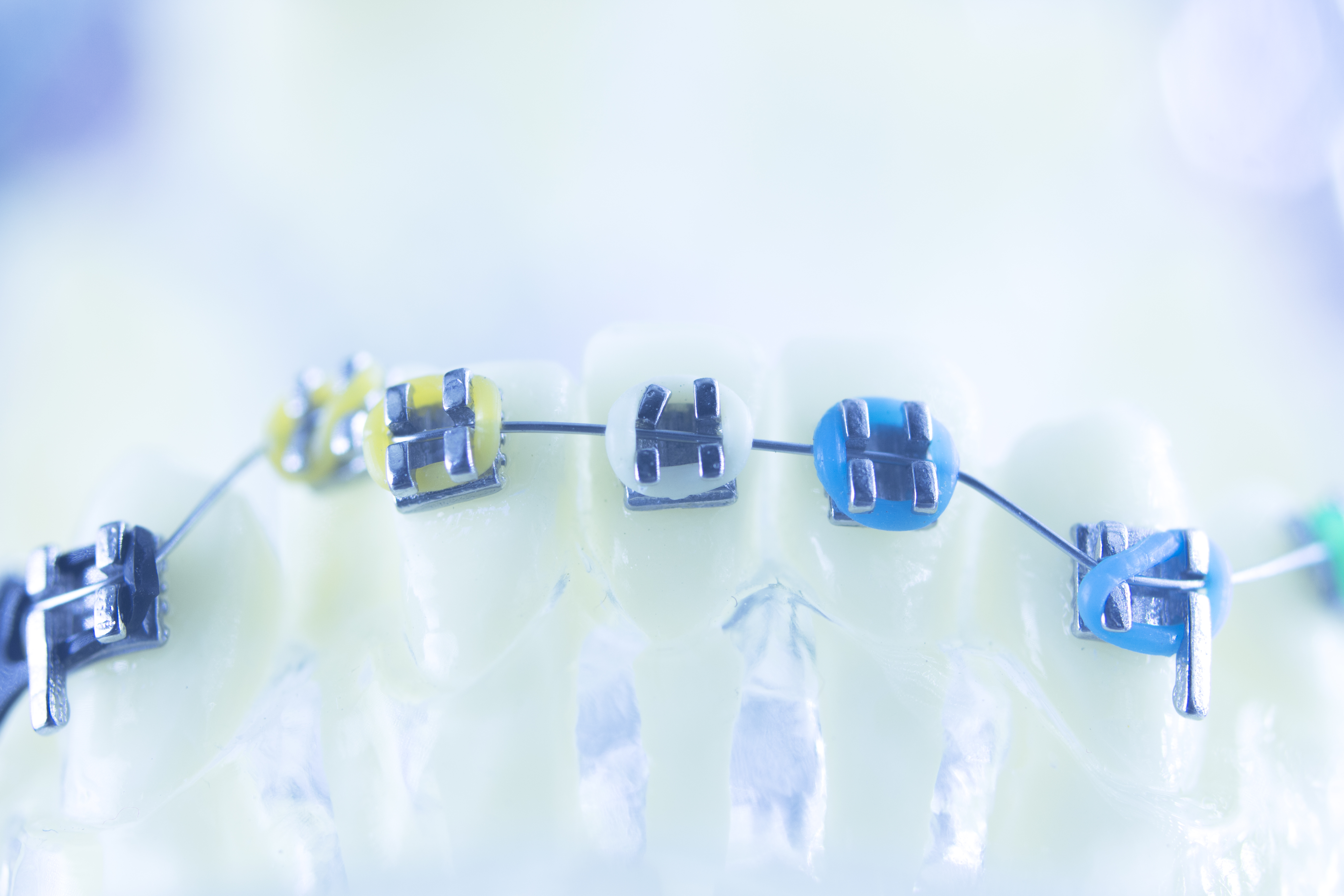 Explore the Orthodontic Treatments, Its Benefits, and How it Improves Individual's Appearance