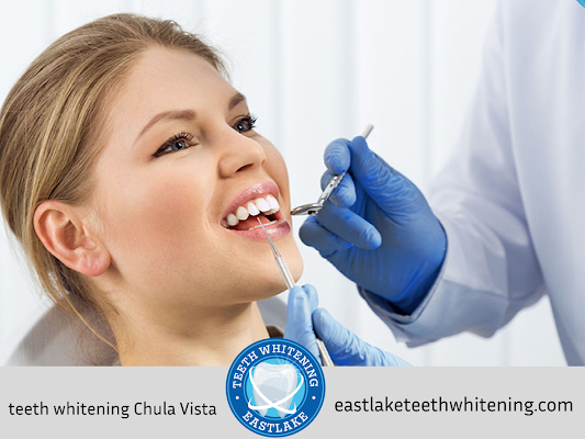 Achieve a Brighter Smile with Professional Teeth Whitening from Eastlake Teeth Whitening in San Diego